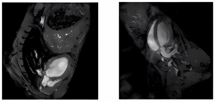 35f1e93bc68ee6337b3bf010341f472a.png