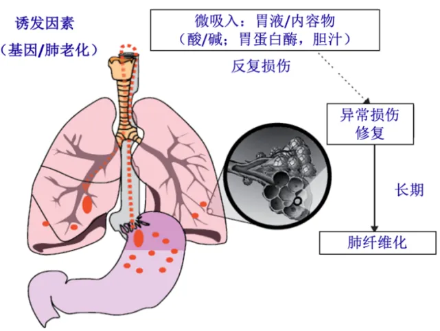 科研干货 | 一站式解决肺纤维化临床前动物研究，助力科学探索与创新